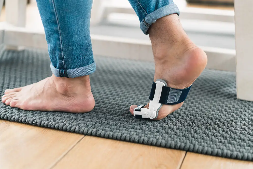 Różne rodzaje ortez na haluksy