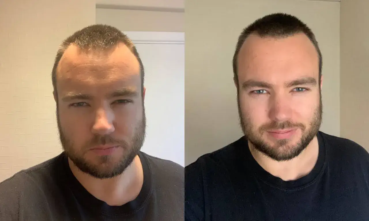Dwa selfie tego samego mężczyzny. Na lewym ma poważniejszy wyraz twarzy, na prawym się uśmiecha. Widać, jak zrobić dobre selfie, zmieniając mimikę.