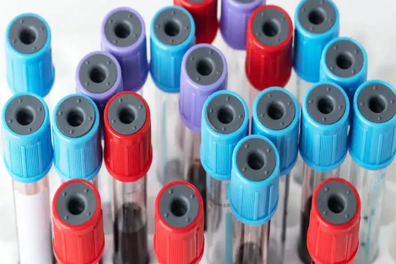 prob&oacute;wka laboratoryjna rodzaje