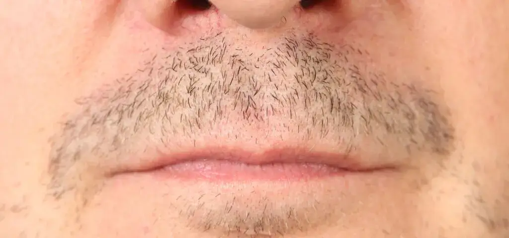 mężczyzna z zarostem, genetyka zarostu, hormony zarost