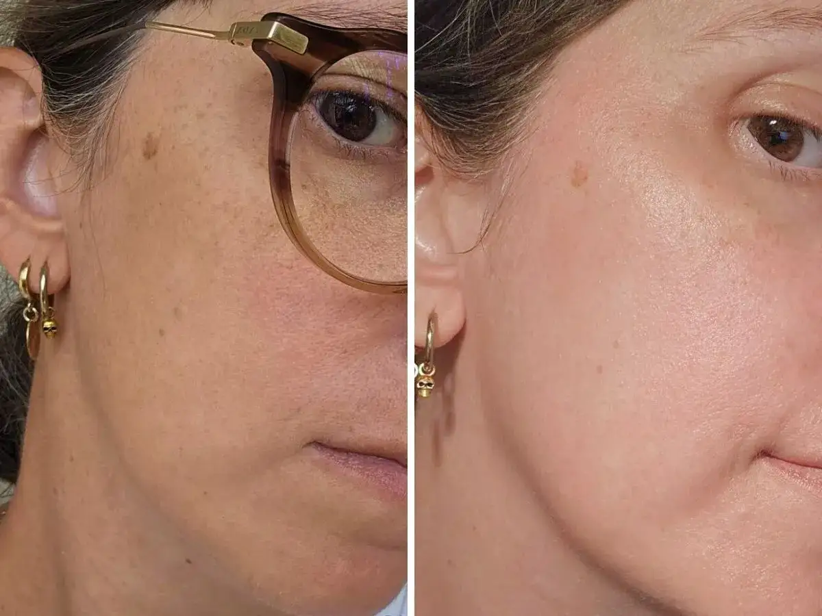 Tołpa Ideal Age Illumi serum rozświetlające składniki i efekty