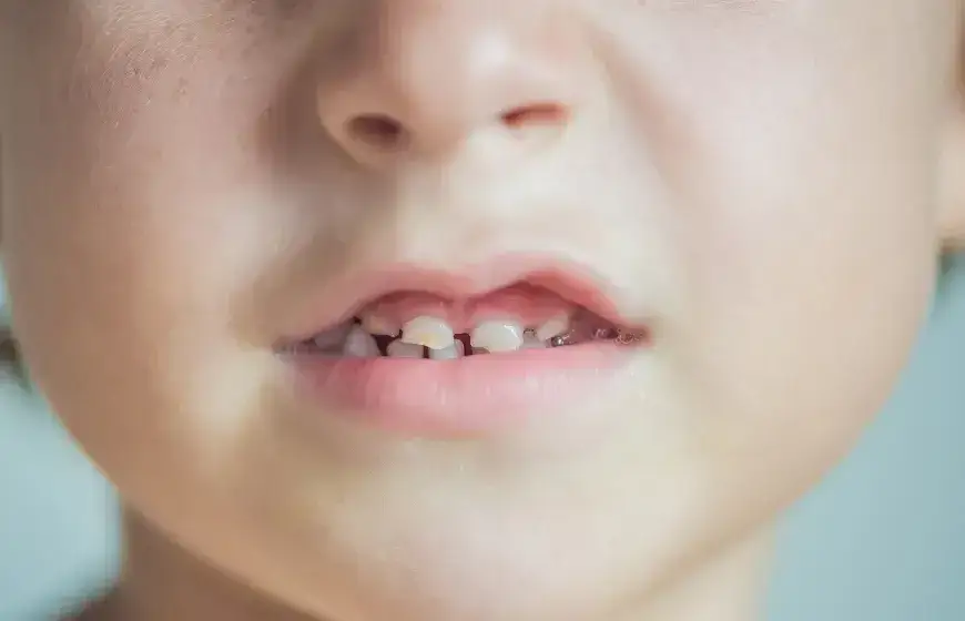 pr&oacute;chnica butelkowa u niemowlaka