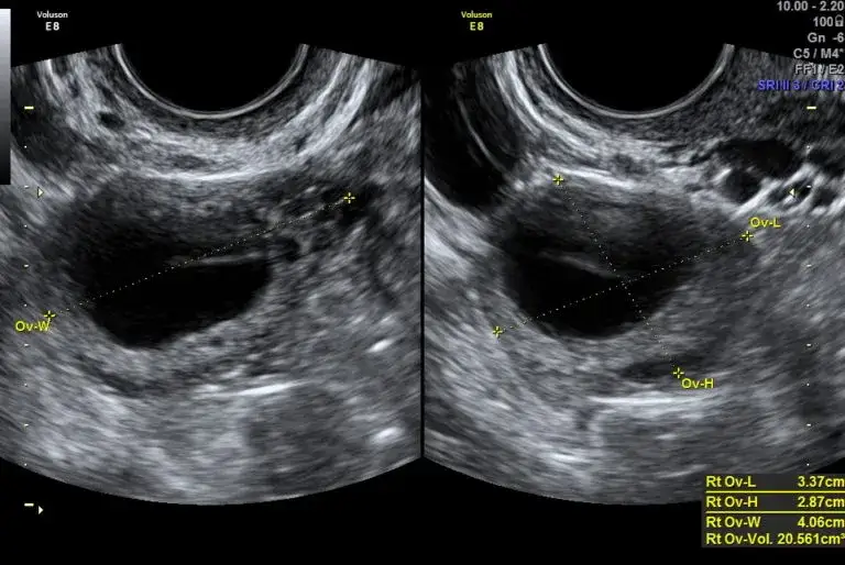 Testy owulacyjne i monitoring USG