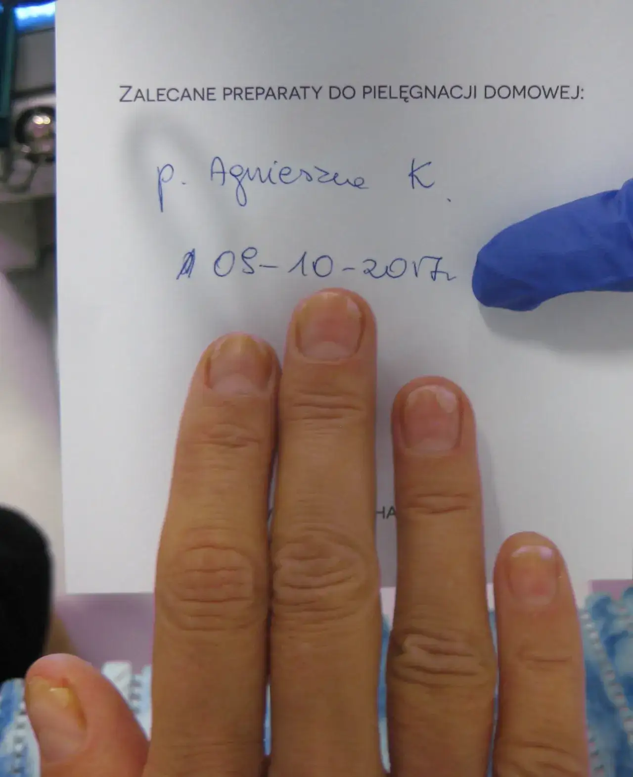 Zdjęcie Jak pobudzić macierz paznokcia i przywrócić ich zdrowy wygląd