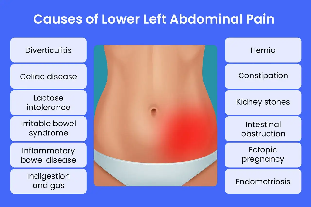 Ilustracja przedstawia brzuch z zaznaczonym czerwonym obszarem bólu w lewym boku. Wymienione są możliwe przyczyny, takie jak zapalenie uchyłków, zespół jelita drażliwego, czy bóle związane z zaparciami.