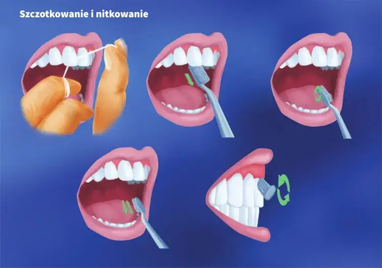Prawidłowe użycie nici dentystycznej