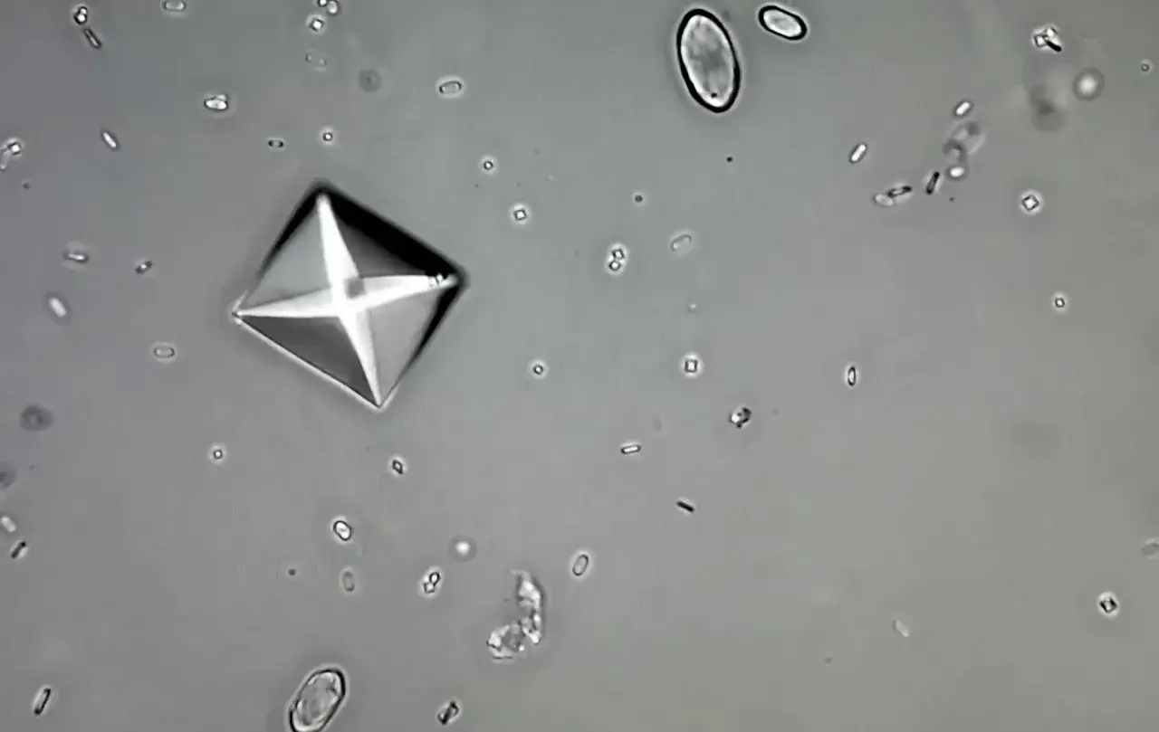 neutralizacja szczawianów wapń