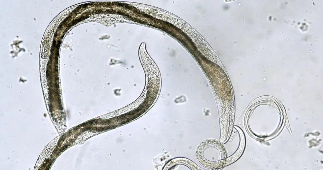 Mikroskopowe robaki w kale, widoczne pod powiększeniem, mogą wskazywać na obecność pasożyt&oacute;w.