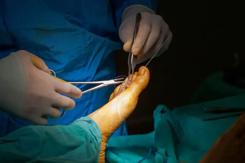 czynniki wpływające na rekonwalescencję po operacji haluksa