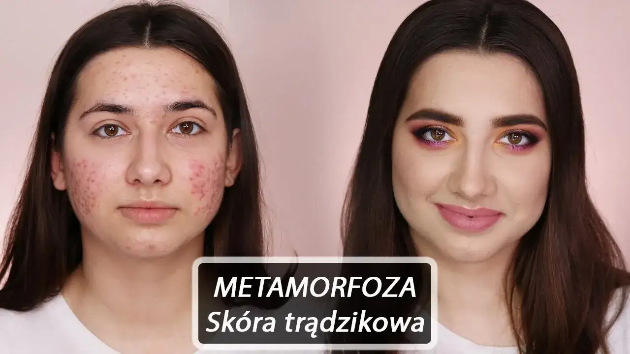 Jak zamaskować pryszcza makijażem krok po kroku