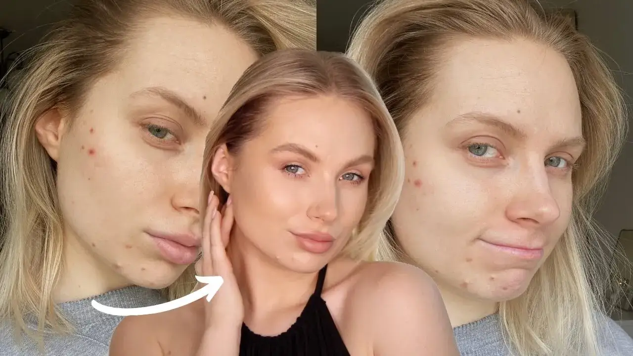 przygotowanie skóry pod makijaż pryszcza