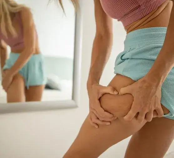 Zdjęcie Jak spalić cellulit na udach - skuteczne metody i porady, które działają