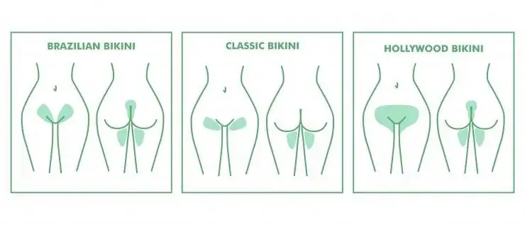 Rodzaje depilacji laserowej bikini schematyczne przedstawienie