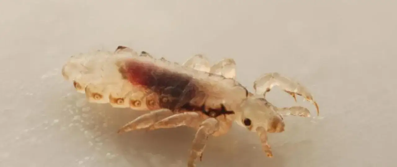 rodzic leczący dziecko wszy instrukcja