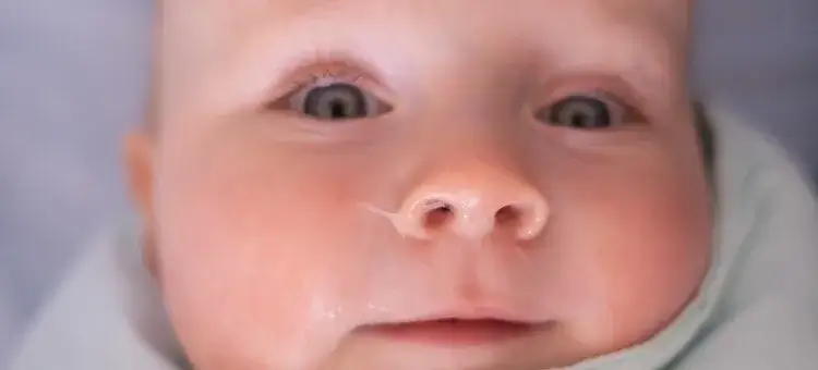 Zdjęcie Jak odetkać nos niemowlakowi - skuteczne metody na katar i ulgę