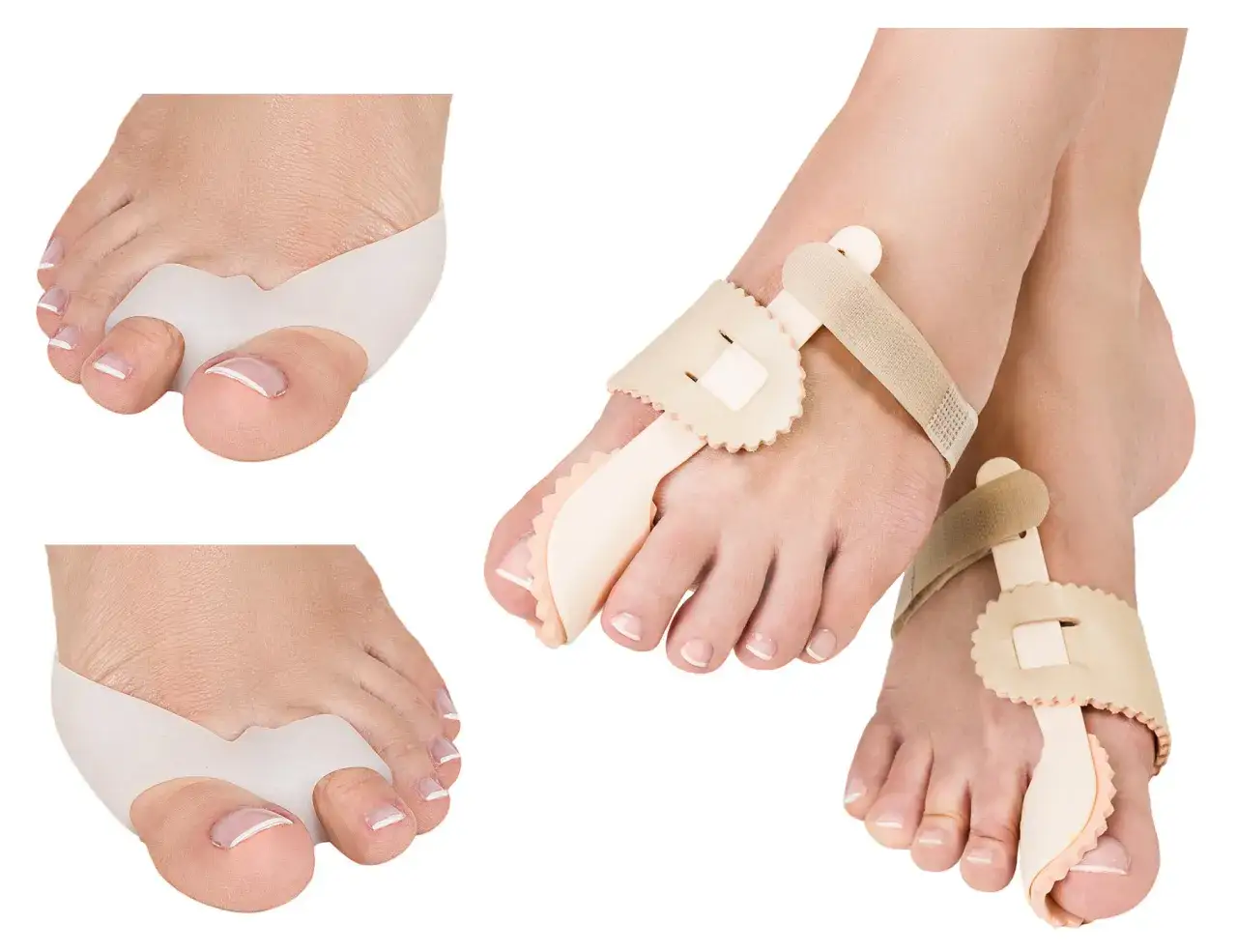 aparaty korekcyjne na haluksy dzienne nocne