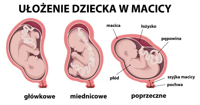 ułożenie płodu w macicy, położenie gł&oacute;wkowe, położenie miednicowe, położenie poprzeczne