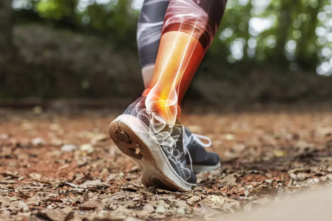 Zdjęcie Jakie buty po skręceniu kostki: Wybierz najlepsze dla komfortu i wsparcia
