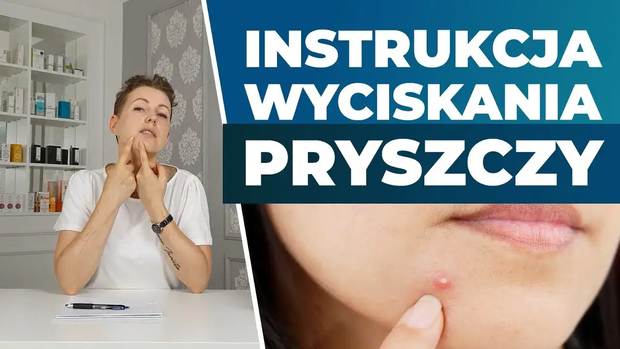 Zdjęcie Jak bezpiecznie wycisnąć pryszcza? Poradnik krok po kroku