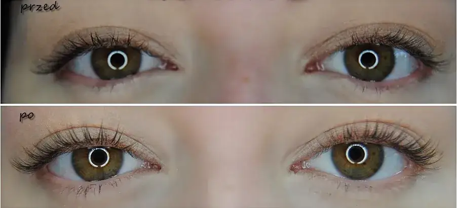 Zdjęcie Lifting rzęs co to - poznaj zalety i przebieg zabiegu