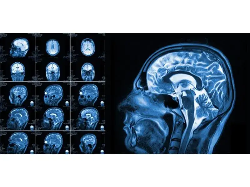 Zdjęcie Czy lekarz rehabilitacji może wystawić skierowanie na rezonans? Sprawdź!