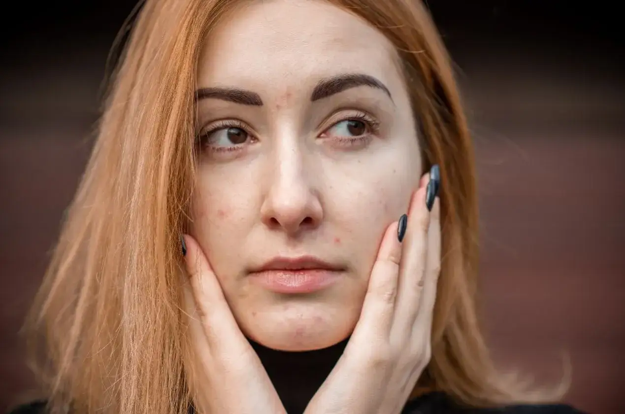 budowa skóry nosa gruczoły łojowe