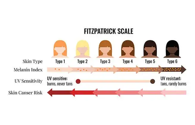 Fototypy skóry Fitzpatricka