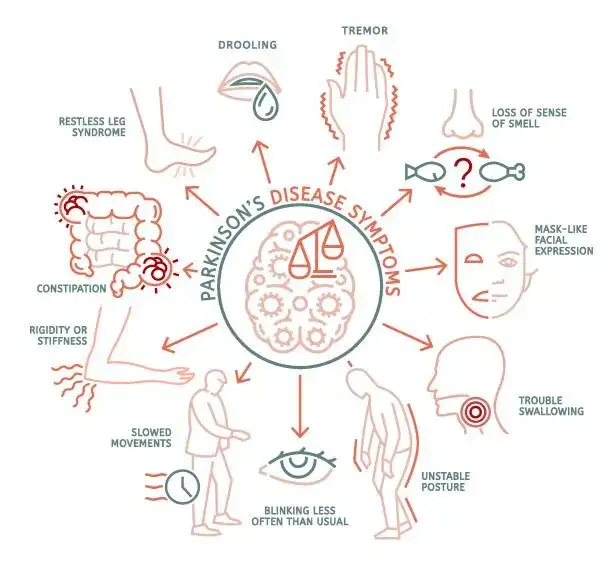 Mapa objawów psychicznych w chorobie Parkinsona