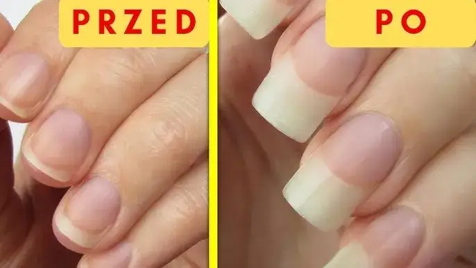 zdrowe paznokcie przed i po diecie