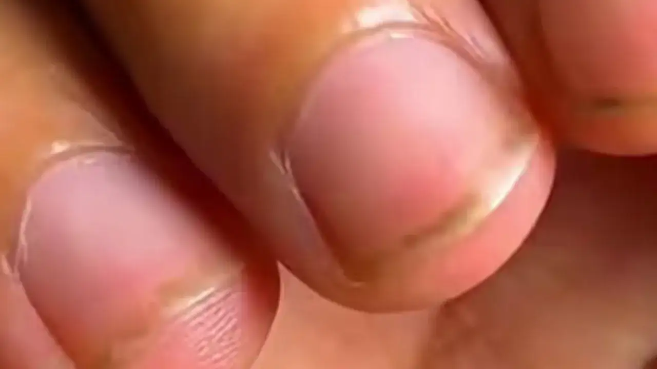 Zdjęcie Co jest pod paznokciami? Odkryj tajemnice zdrowia Twoich paznokci