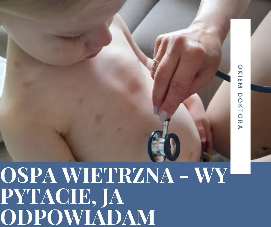 Zdjęcie Czy rodzeństwo dziecka z ospą może chodzić do przedszkola? Ważne informacje