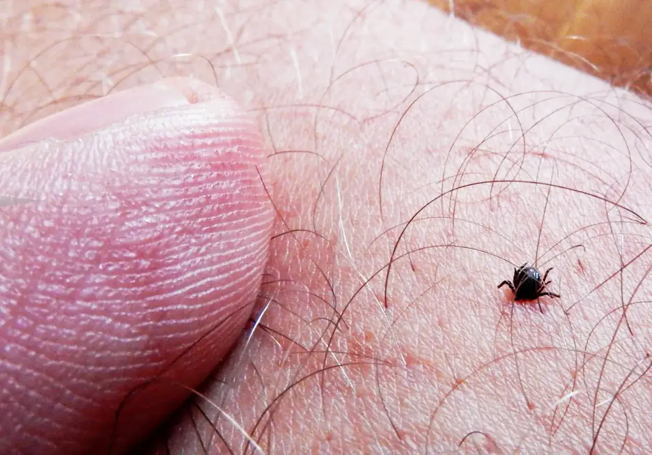 Zdjęcie Do jakiego lekarza z kleszczem? Objawy, które mogą zaniepokoić