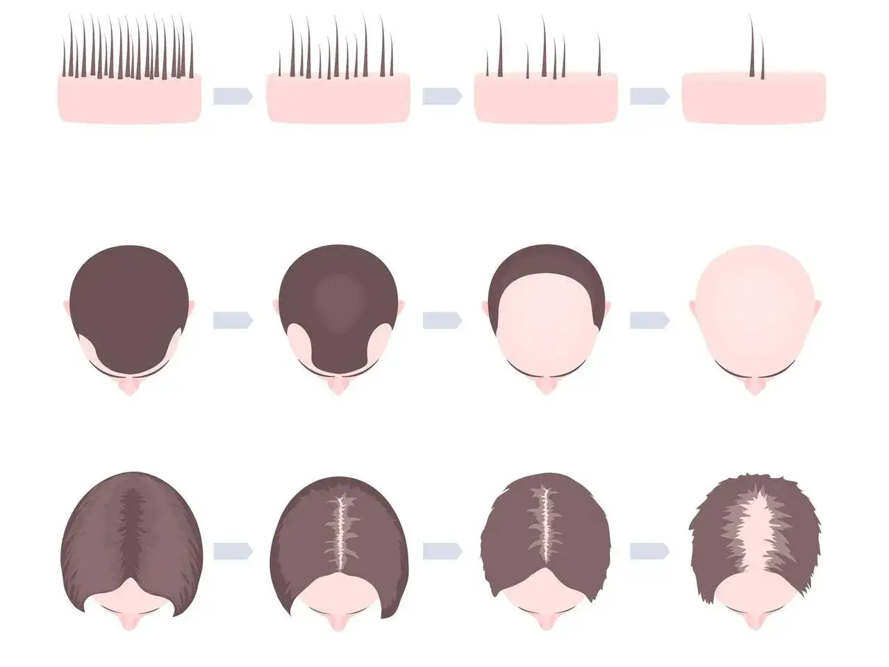 Zdjęcie Kiedy wycierają się włosy u niemowlaka i co warto wiedzieć?