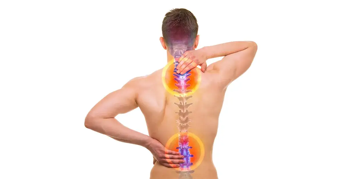 Zdjęcie Objawy bólu kręgosłupa: rozpoznaj, zanim będzie za późno