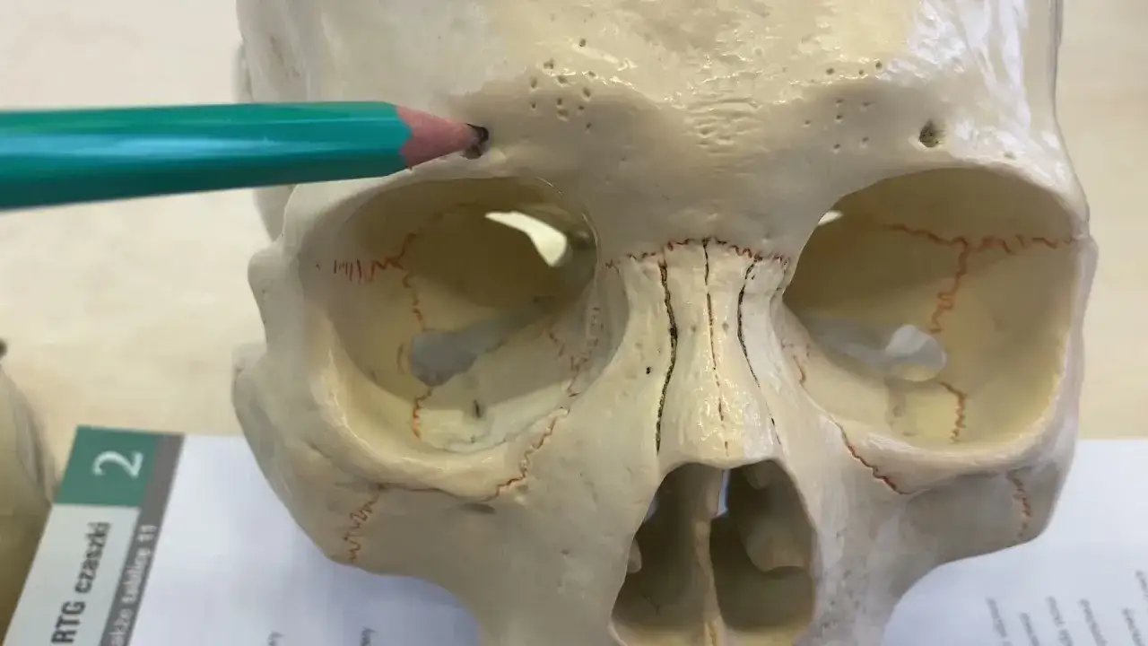 Zdjęcie Kości na twarzy: anatomia i wpływ na wygląd twarzoczaszki