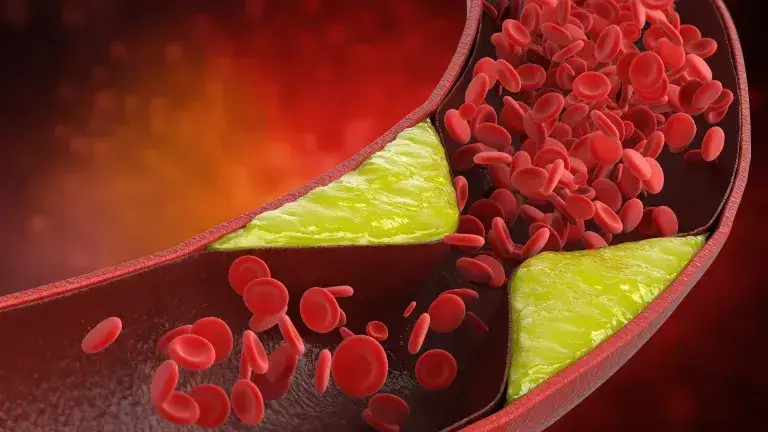 Zdjęcie Czy alkohol wpływa na cholesterol? Poznaj zaskakujące fakty o HDL i LDL