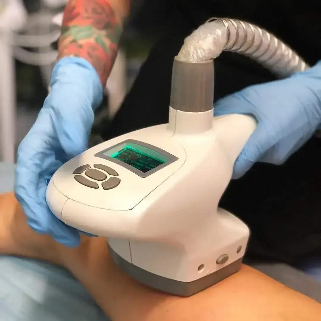 Zdjęcie Liposukcja kawitacyjna - kiedy zobaczysz efekty zabiegu?