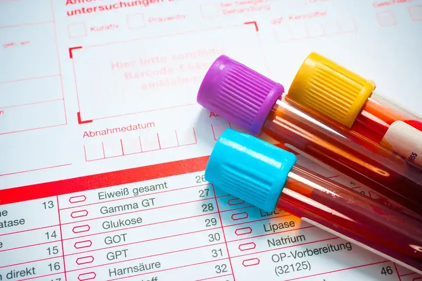 Zdjęcie Borrelien Blutuntersuchung: Wichtige Informationen zur Diagnose von Lyme-Borreliose