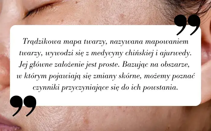 Zdjęcie Dlaczego masz pryszcze na policzkach? Odkryj prawdziwe źródło