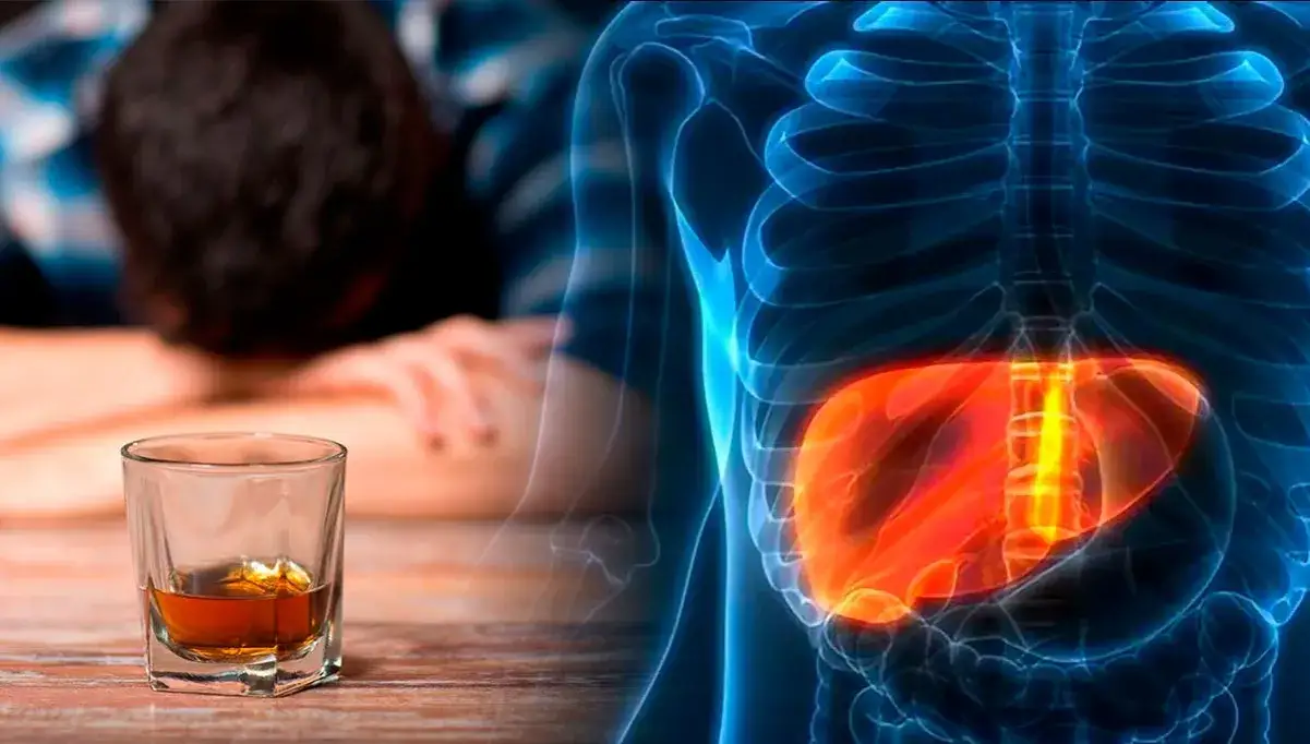Zdjęcie Medicamentos para el h&iacute;gado alcoh&oacute;lico: &iquest;realmente protegen tu salud?