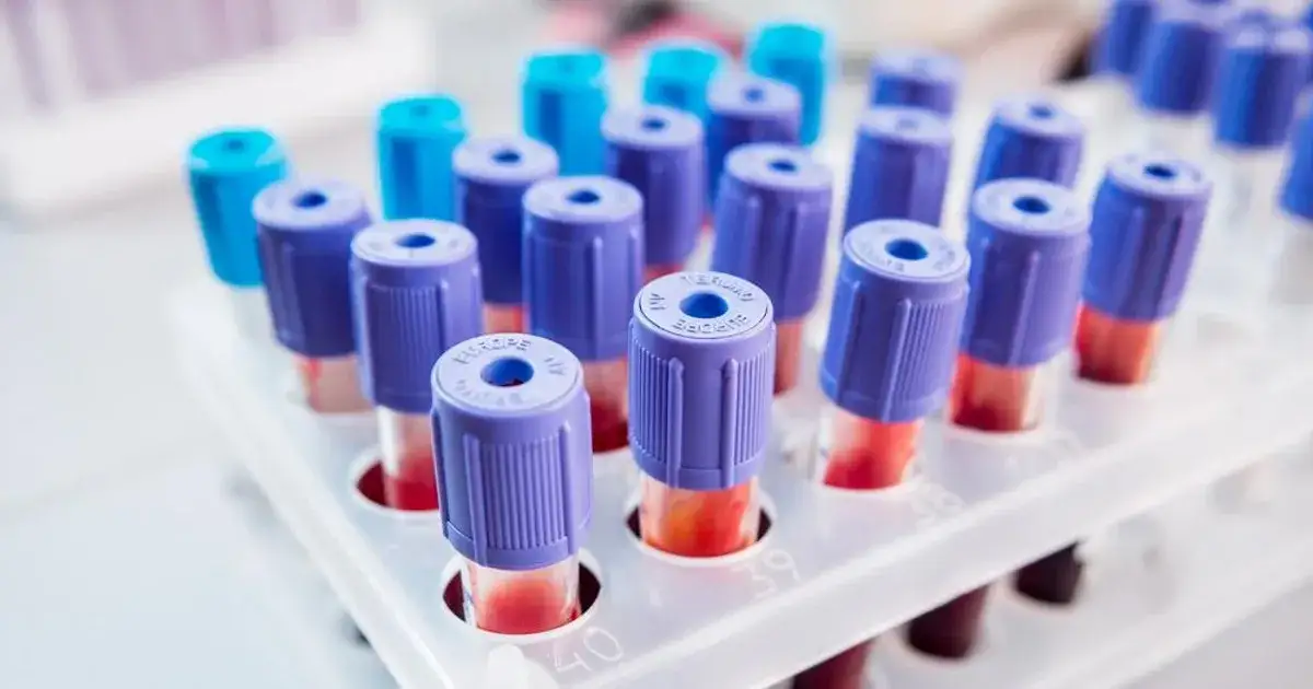 Zdjęcie Bolące nerki: jakie badania pomogą zidentyfikować przyczynę bólu