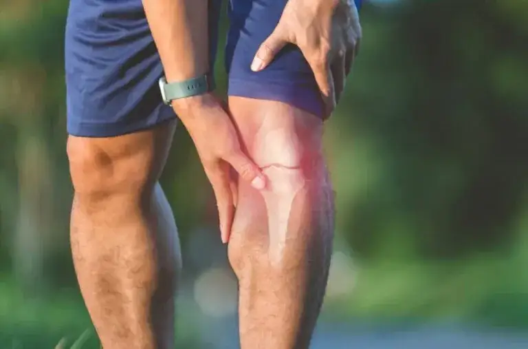 Zdjęcie Jak wygląda skręcone kolano? Objawy, które musisz znać