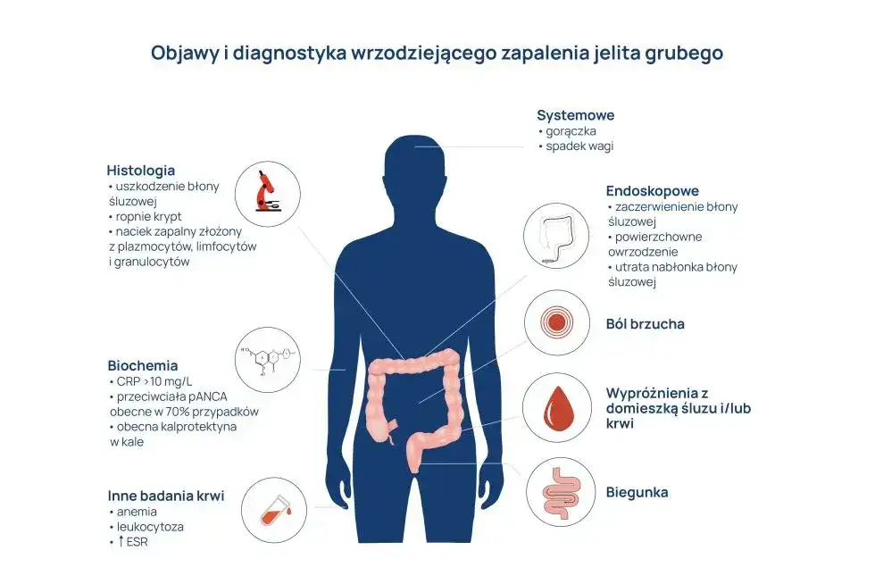 Zdjęcie Objawy zapalenia jelit – jak je rozpoznać i co mogą oznaczać