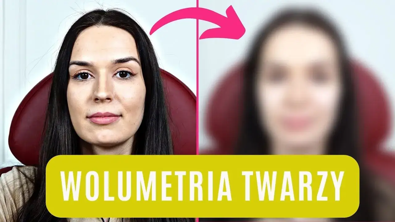 Zdjęcie Radiesse czy kwas hialuronowy - co wybrać dla najlepszych efektów?