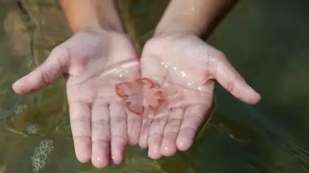 Zdjęcie Jakie meduzy żyją w Bałtyku i jak unikać ich bolesnych oparzeń
