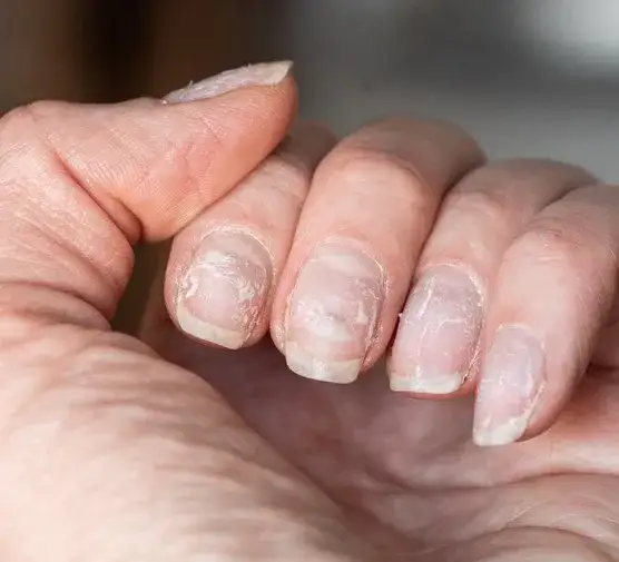 Zdjęcie Jak wyczyścić matowe paznokcie i uniknąć ich brudzenia