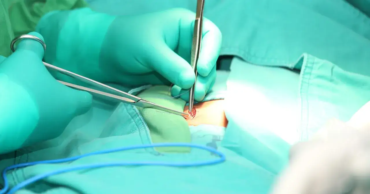 Zdjęcie Przepuklina kresy białej u dziecka: objawy, leczenie i powikłania