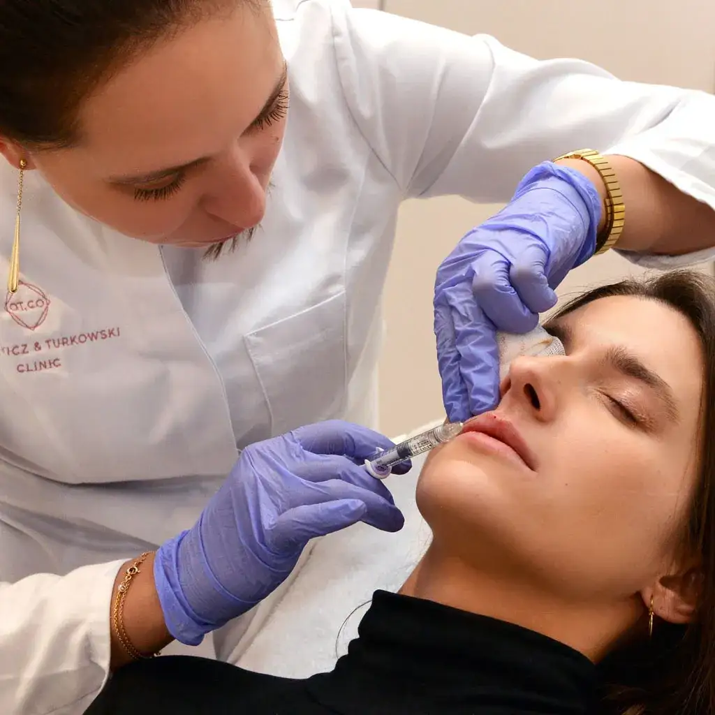 Zdjęcie Powiększanie ust ile ml - jak wybrać odpowiednią ilość kwasu hialuronowego