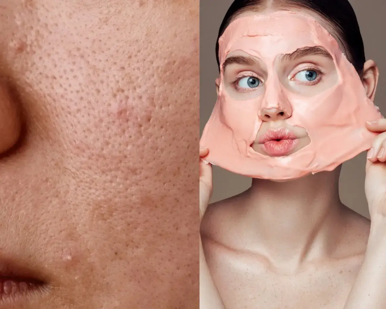 Zdjęcie Jak wygląda zapchana cera? Rozpoznaj objawy i skutecznie ją oczyść