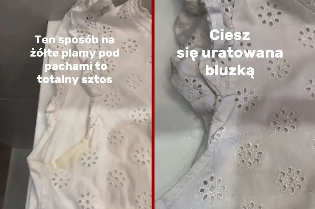 Zdjęcie Jak wywabić żółte plamy z białej bluzki - skuteczne metody na trudne plamy